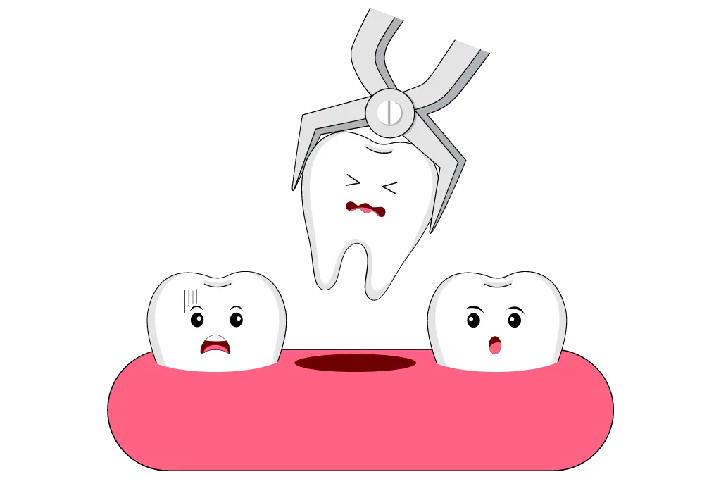 Pediatric Tooth Extractions in Houston