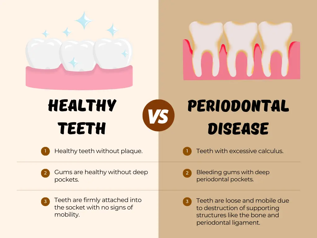 Comparison of healthy gums vs. gums affected by periodontal disease
