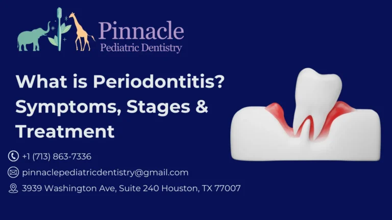 What is Periodontitis? Symptoms, Stages & Treatment