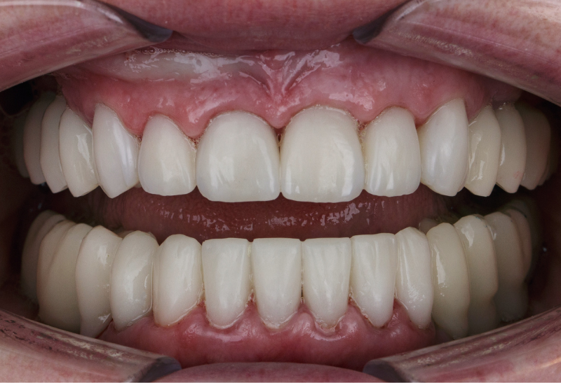 Oral Lacerations for Kids In Houston, TX