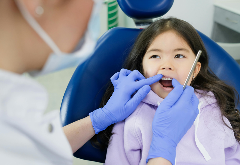 Pediatric Silver Diamine Flouride Treatment in Houson